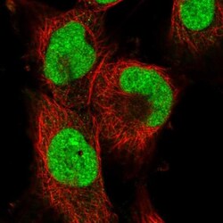 Apc11 Antibody, Novus Biologicals:Antibodies:Primary Antibodies